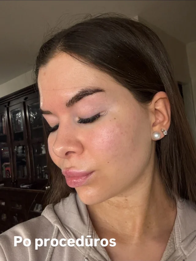 Instagram image